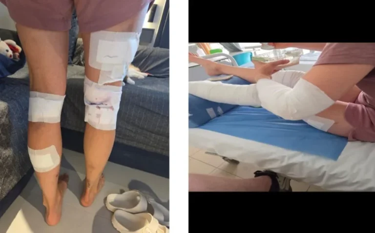 ολλανδι τραθματισμοσ