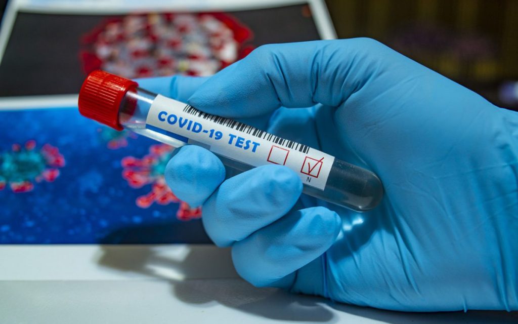 coronovirus