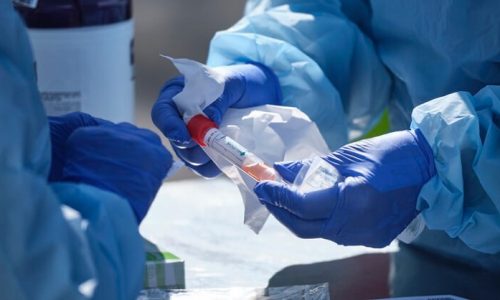 epa08308213 Nurses prepare a test kit before collecting a specimen from a patient at a coroanvirus drive through testing location in Seattle, Washington, USA, 19 March 2020. UW Medicine is offering COVID-19 tests to patients with appointments after an initial screening.  EPA/STEPHEN BRASHEAR