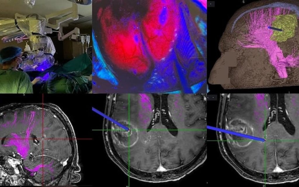 neuroxeirourgiki